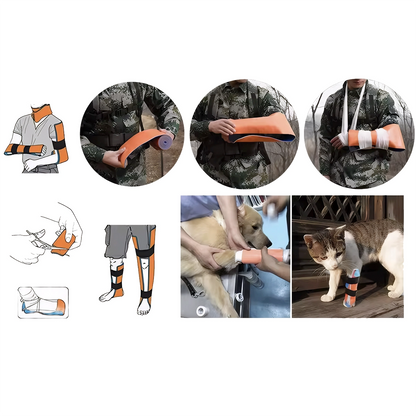 UNI-SPLINT Aluminum Splint Roll